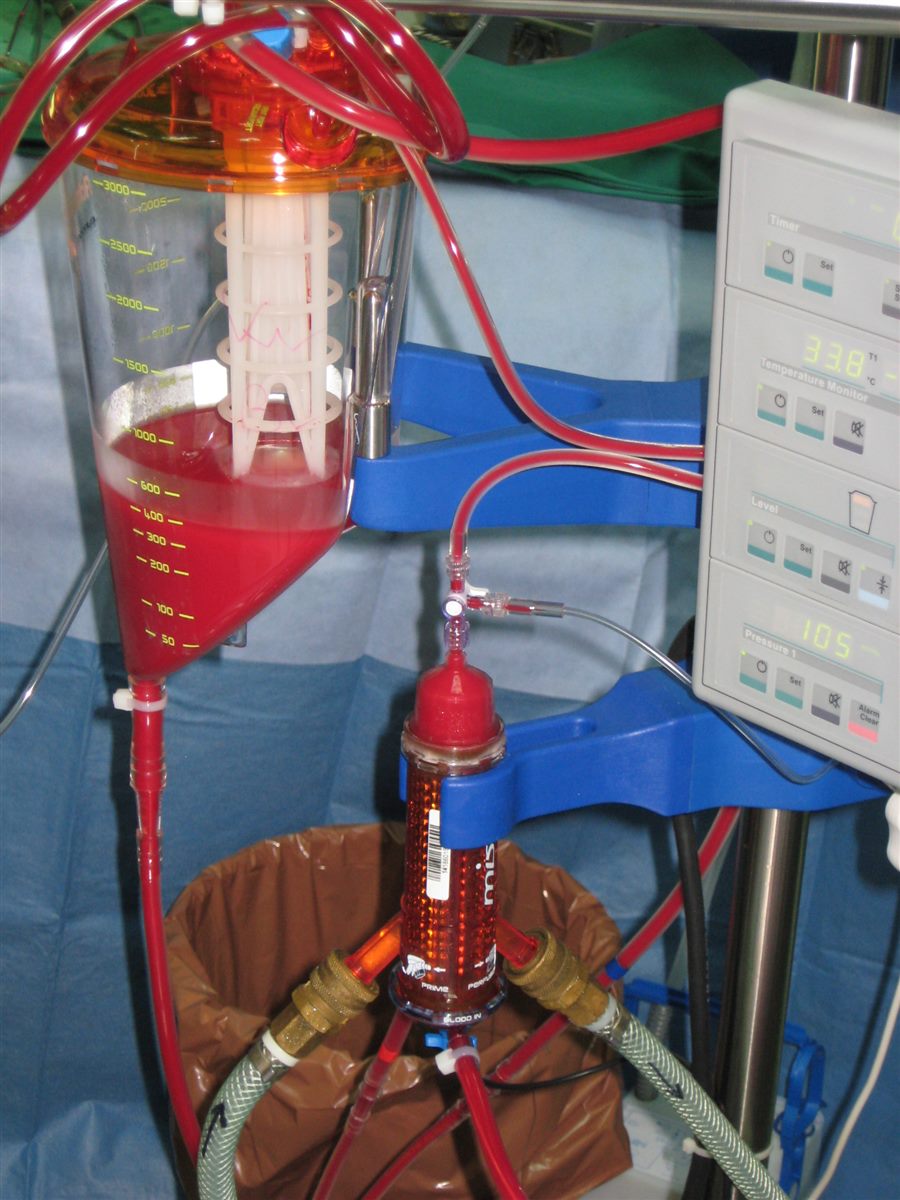 Detalj perfuzionog sistema